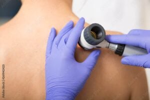 Desvendando o Segredo da Juventude: As Últimas Inovações em Dermatologia Estética para Rejuvenescimento da Pele