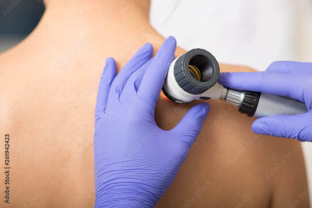 Desvendando o Segredo da Juventude: As Últimas Inovações em Dermatologia Estética para Rejuvenescimento da Pele dermatologista