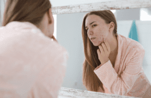 Tratamentos para Acne: O Que um Dermatologista Recomenda